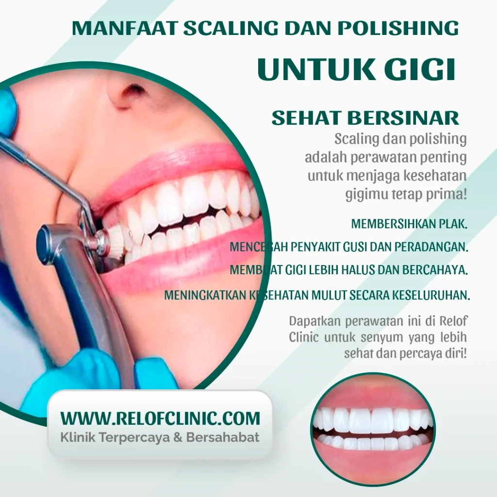 biaya scaling gigi di dokter gigi relof