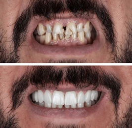 perbaikan dan perawatan gigi